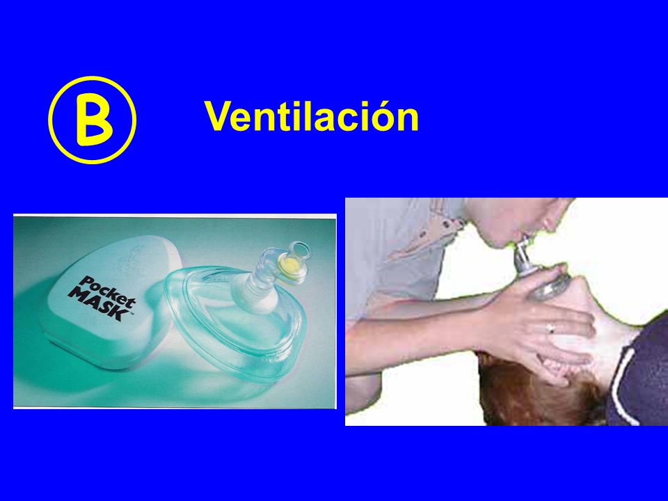 B Ventilación