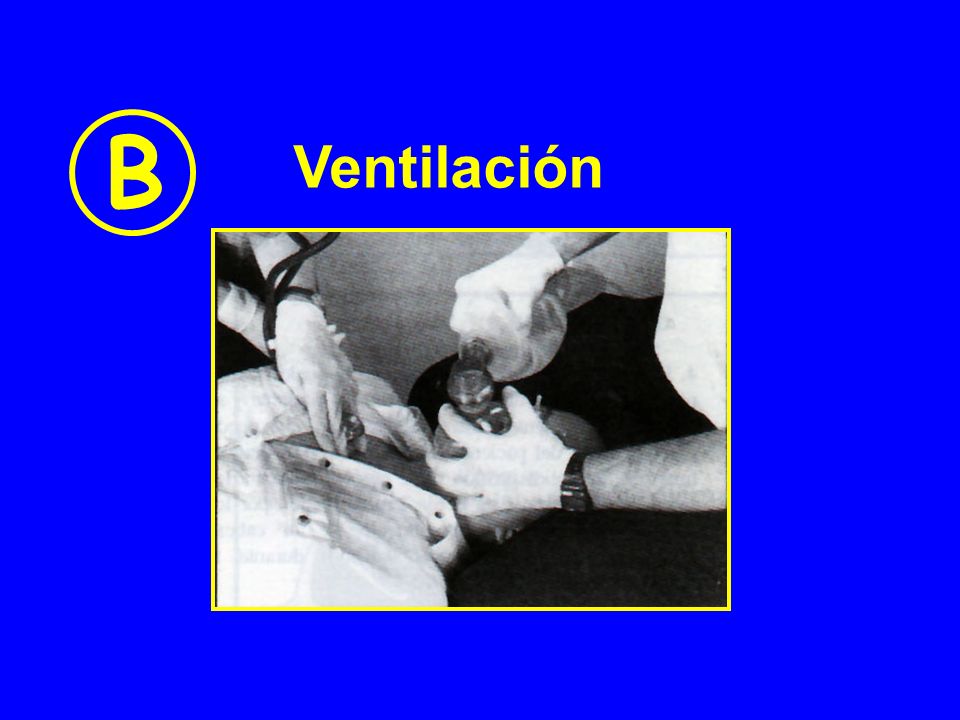 B Ventilación