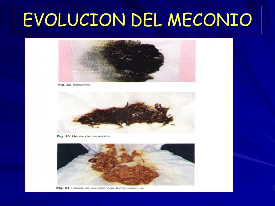 EVOLUCION DEL MECONIO