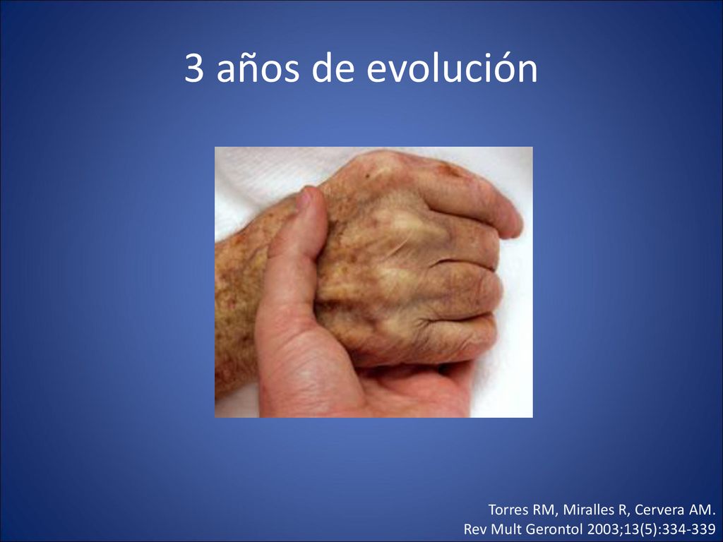 3 años de evolución Torres RM, Miralles R, Cervera AM.