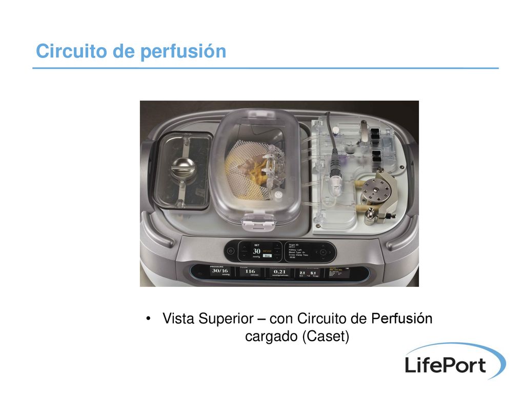 Vista Superior – con Circuito de Perfusión cargado (Caset)