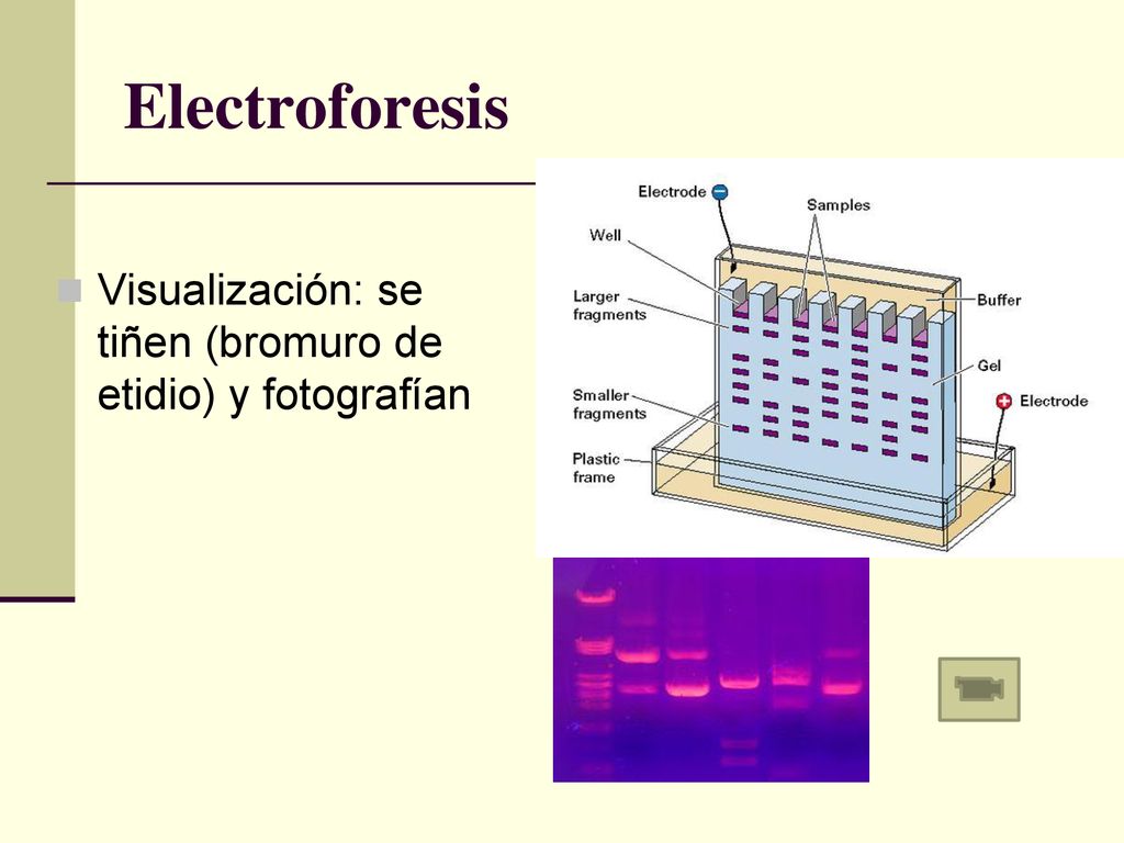Electroforesis Visualización: se tiñen (bromuro de etidio) y fotografían