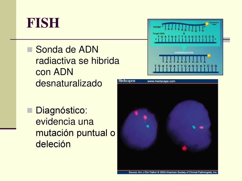 FISH Sonda de ADN radiactiva se hibrida con ADN desnaturalizado