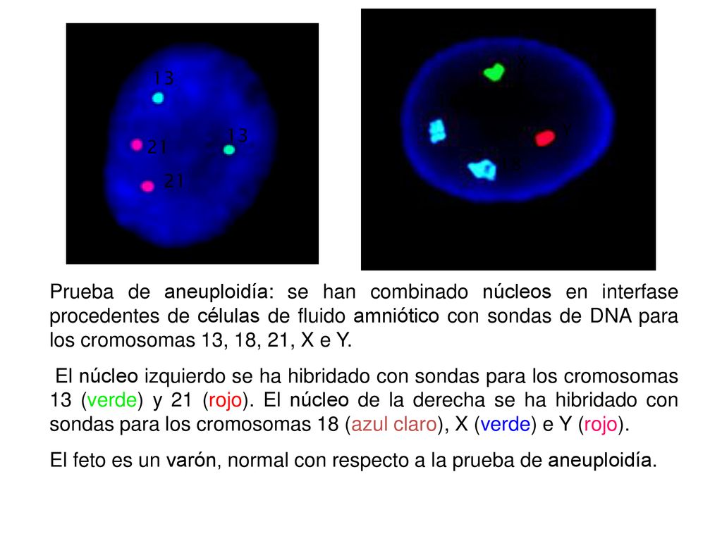 El feto es un varón, normal con respecto a la prueba de aneuploidía.