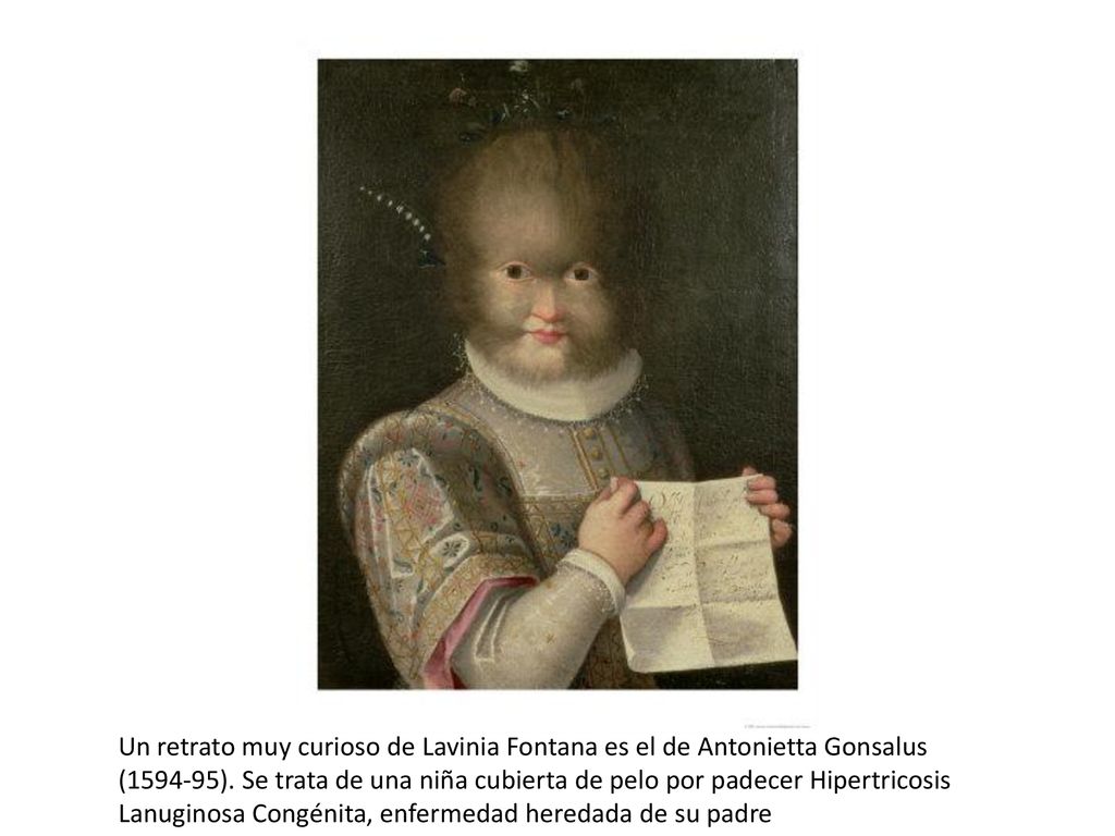 Un retrato muy curioso de Lavinia Fontana es el de Antonietta Gonsalus ( ).