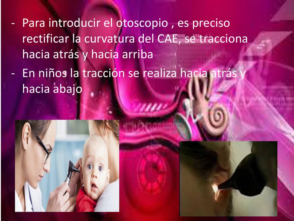 Para introducir el otoscopio , es preciso rectificar la curvatura del CAE, se tracciona hacia atrás y hacia arriba