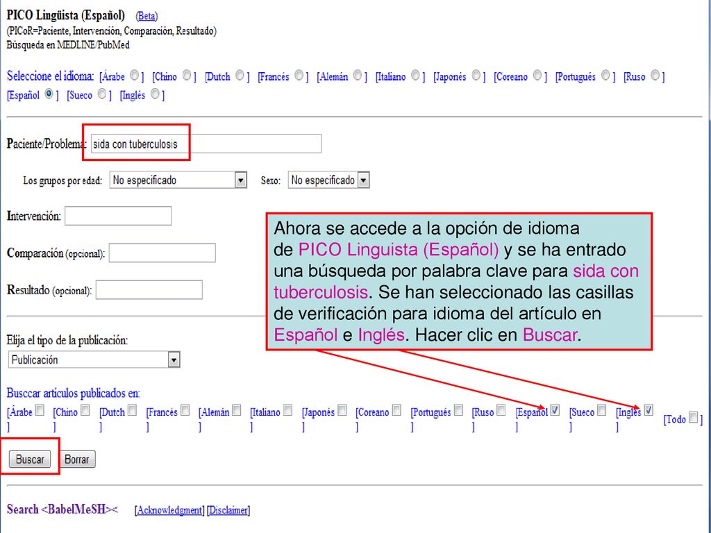 Ahora se accede a la opción de idioma de PICO Linguista (Español) y se ha entrado una búsqueda por palabra clave para sida con tuberculosis. Se han seleccionado las casillas de verificación para idioma del artículo en Español e Inglés. Hacer clic en Buscar.