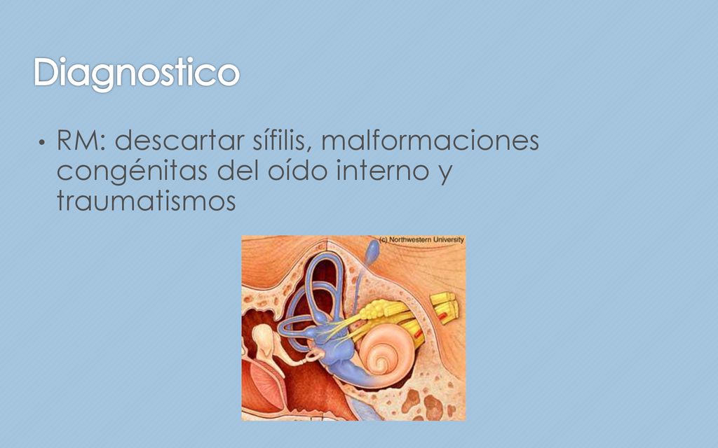 Diagnostico RM: descartar sífilis, malformaciones congénitas del oído interno y traumatismos. Maniobra de Epley.