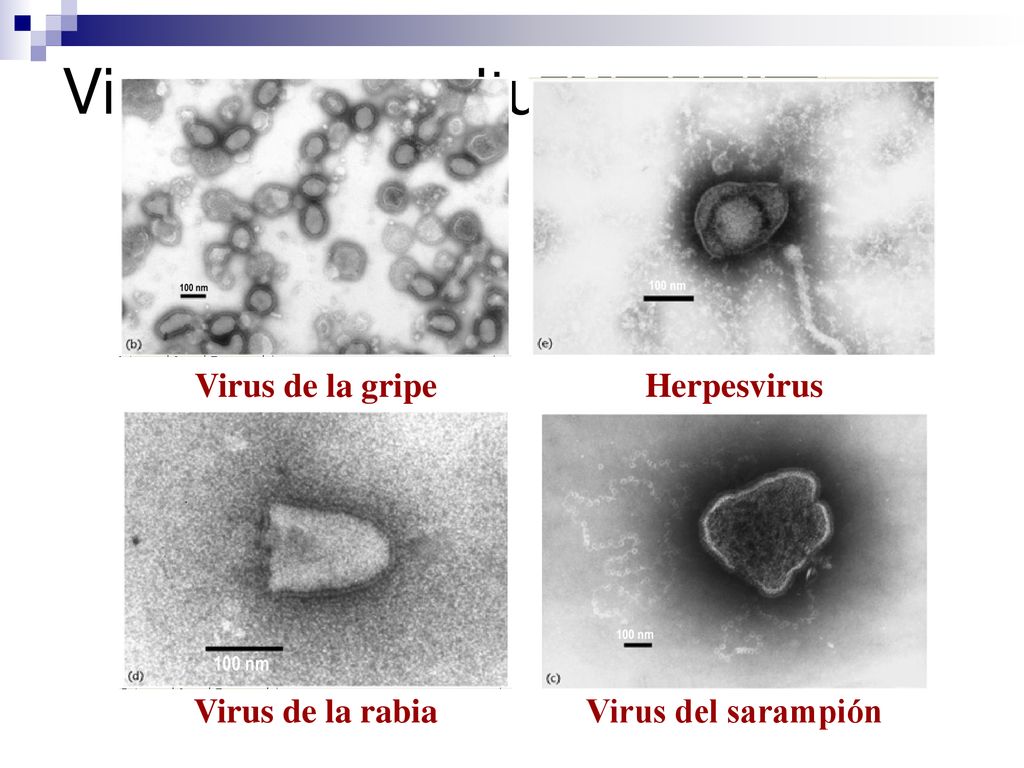 Virus con envoltura Virus de la gripe Herpesvirus Virus de la rabia
