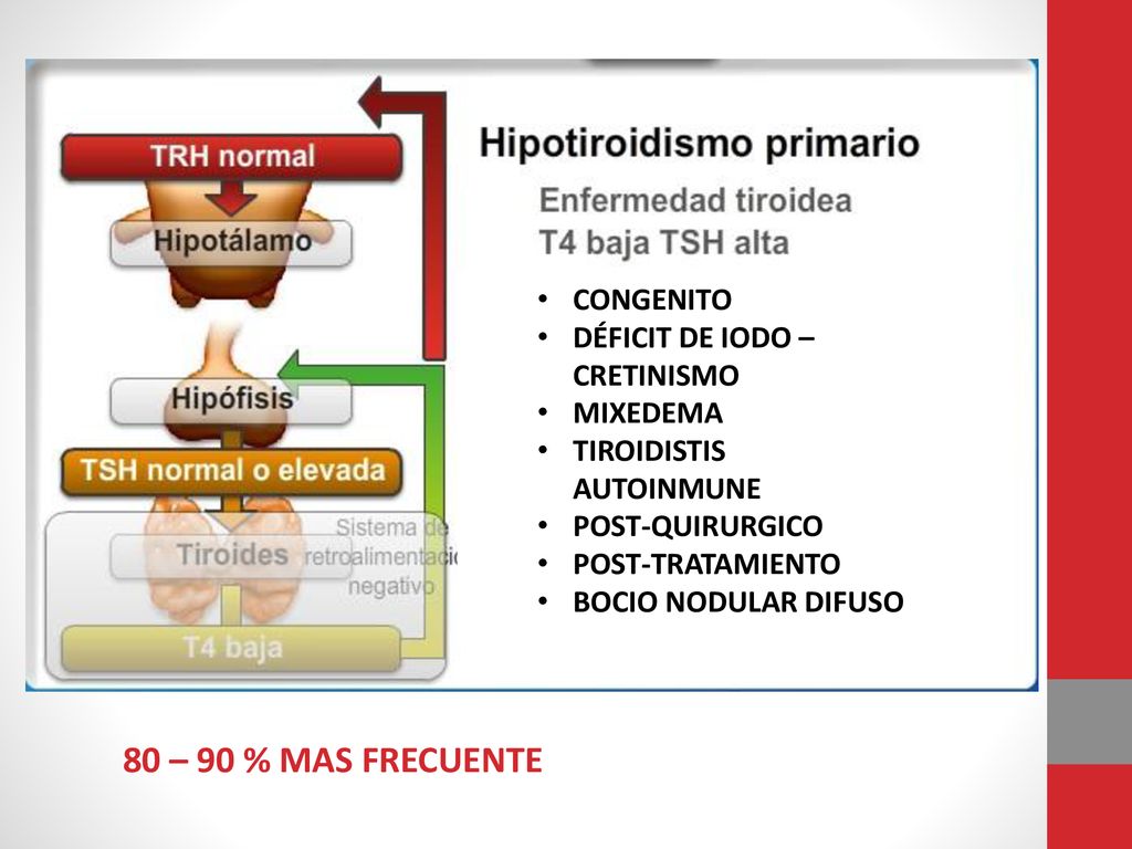 80 – 90 % MAS FRECUENTE CONGENITO DÉFICIT DE IODO – CRETINISMO