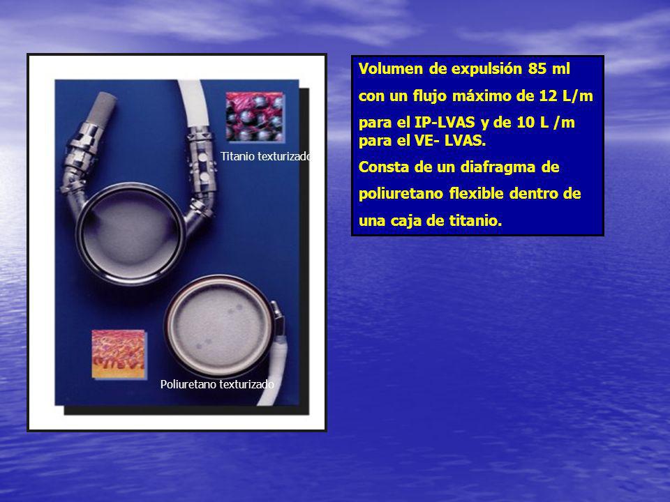 Volumen de expulsión 85 ml con un flujo máximo de 12 L/m