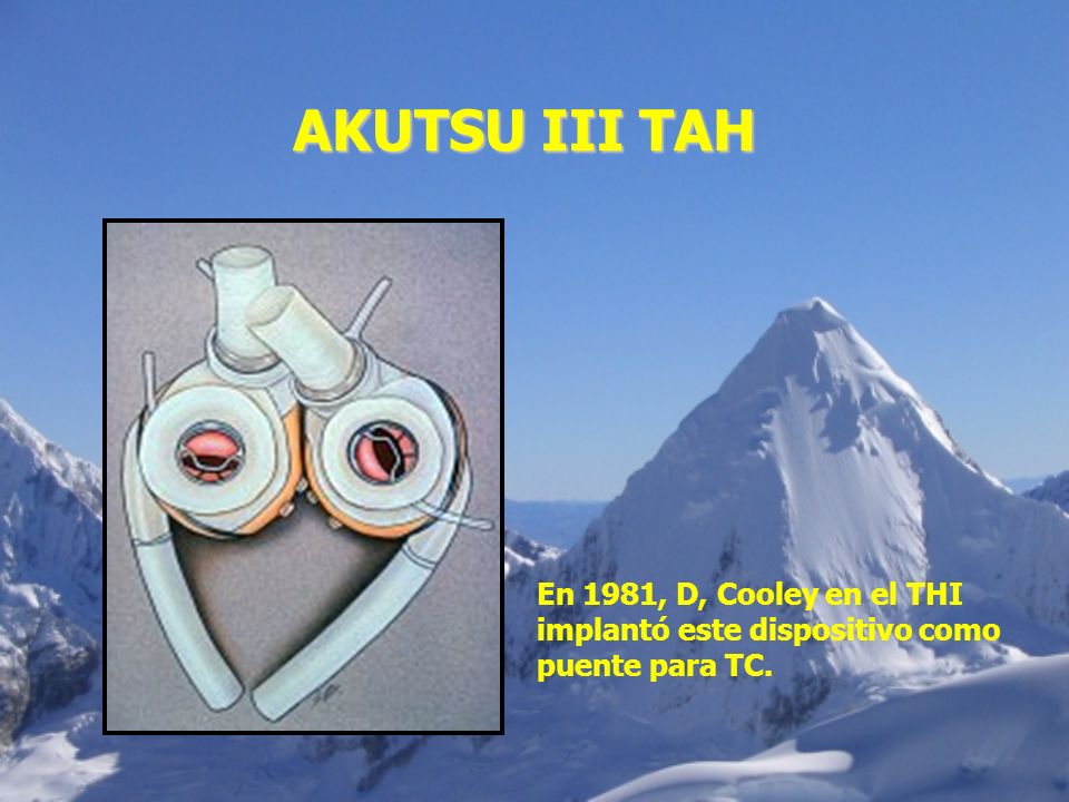 AKUTSU III TAH En 1981, D, Cooley en el THI implantó este dispositivo como puente para TC.