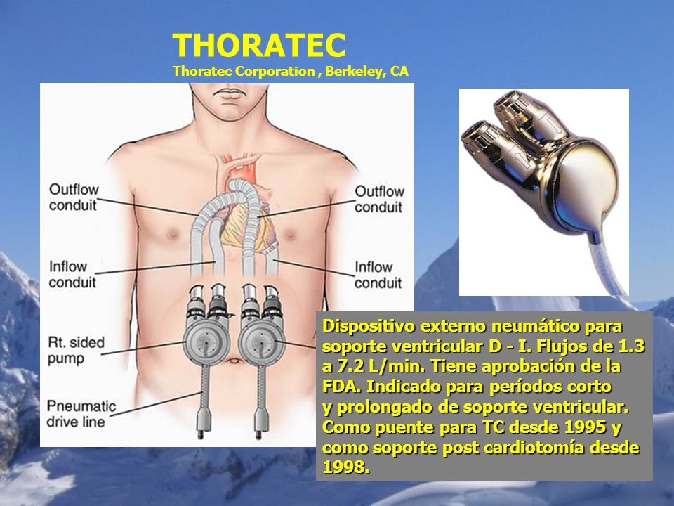 THORATEC Thoratec Corporation , Berkeley, CA.