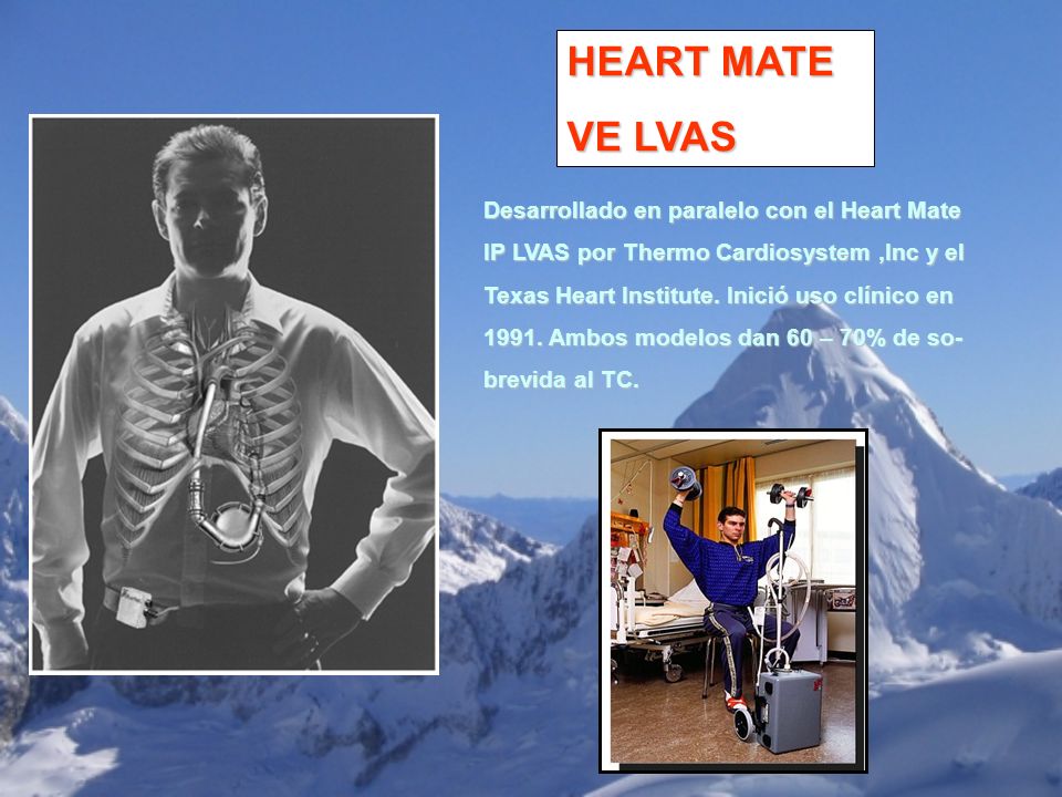 HEART MATE VE LVAS Desarrollado en paralelo con el Heart Mate