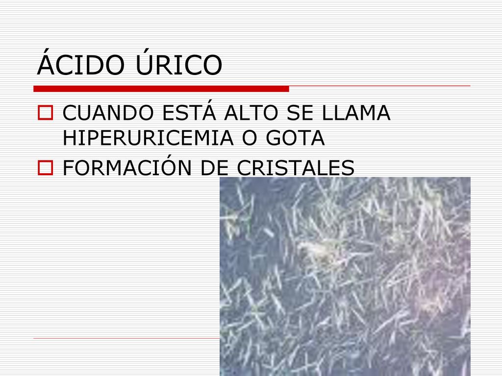 ÁCIDO ÚRICO CUANDO ESTÁ ALTO SE LLAMA HIPERURICEMIA O GOTA