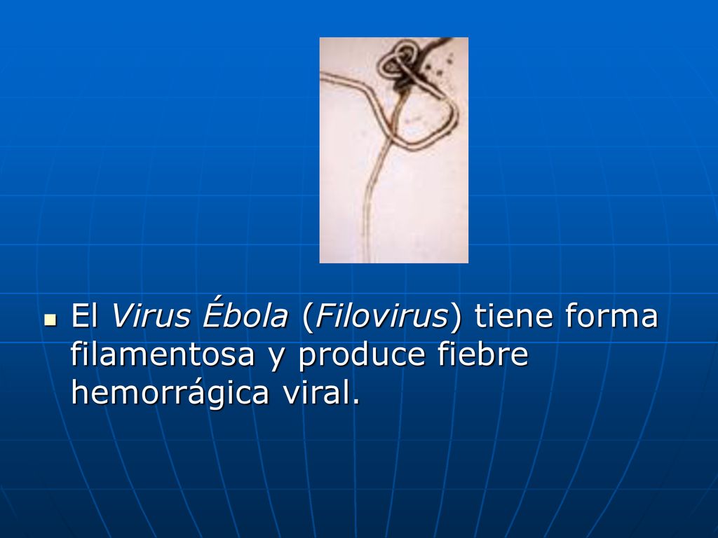El Virus Ébola (Filovirus) tiene forma filamentosa y produce fiebre hemorrágica viral.