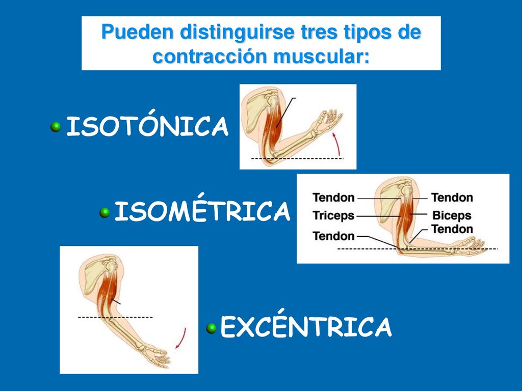 Pueden distinguirse tres tipos de contracción muscular: