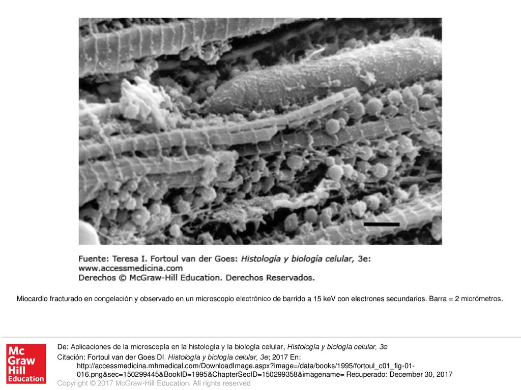 Miocardio fracturado en congelación y observado en un microscopio electrónico de barrido a 15 keV con electrones secundarios. Barra = 2 micrómetros.