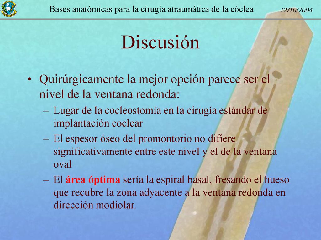 Discusión Quirúrgicamente la mejor opción parece ser el nivel de la ventana redonda: