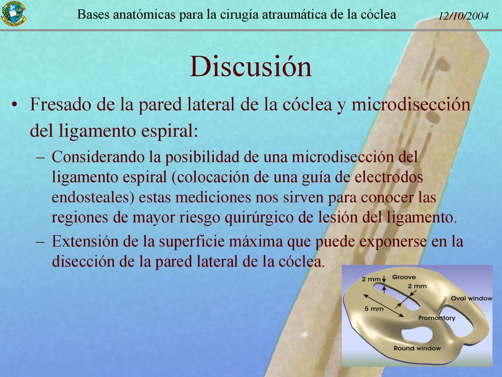 Discusión Fresado de la pared lateral de la cóclea y microdisección del ligamento espiral: