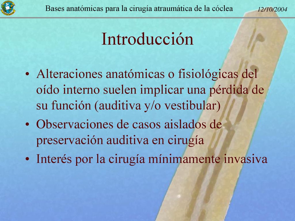 Introducción Alteraciones anatómicas o fisiológicas del oído interno suelen implicar una pérdida de su función (auditiva y/o vestibular)