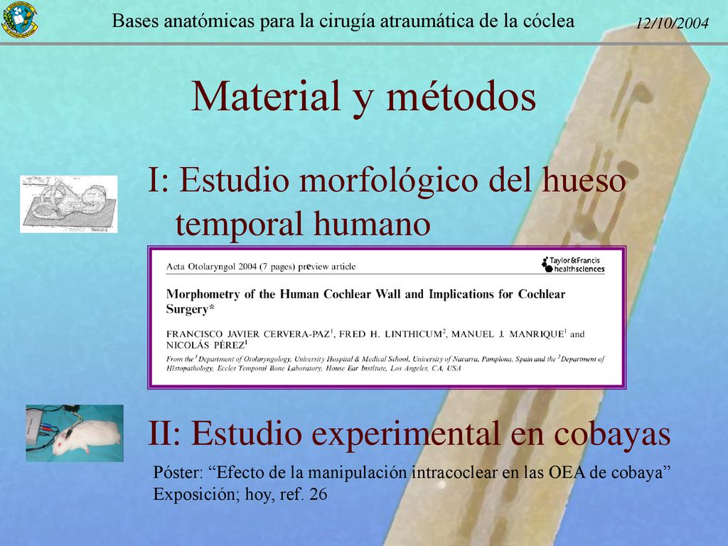 Material y métodos I: Estudio morfológico del hueso temporal humano