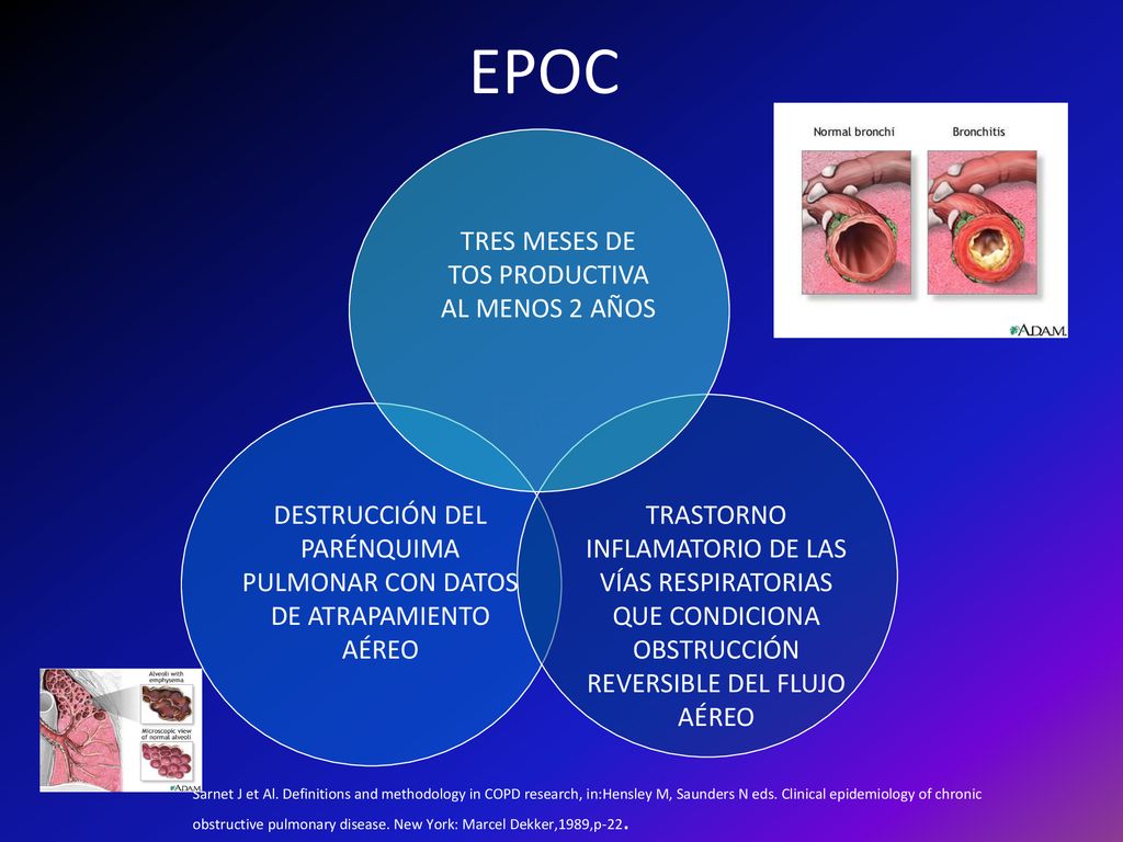EPOC BC Enfisema Asma TRES MESES DE TOS PRODUCTIVA AL MENOS 2 AÑOS