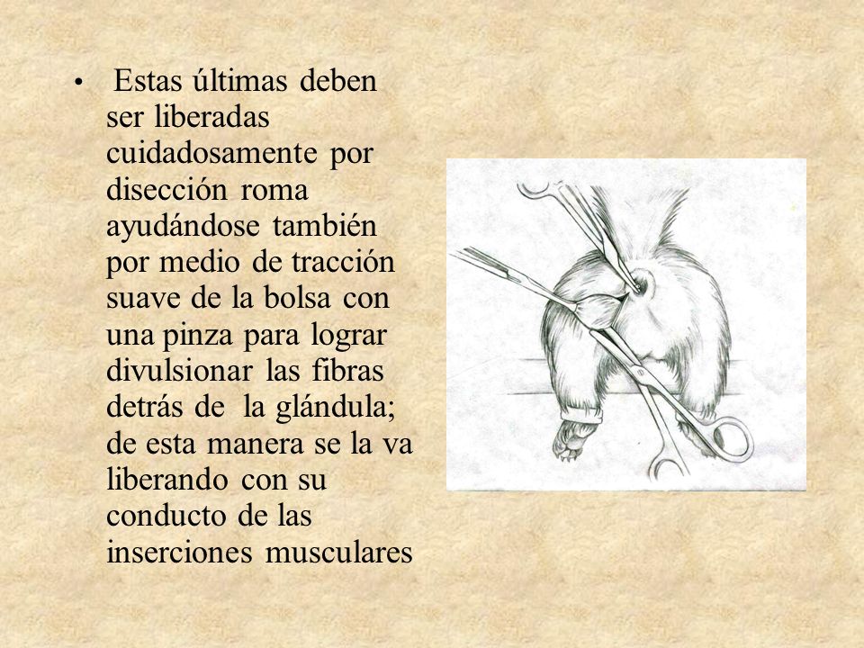 Estas últimas deben ser liberadas cuidadosamente por disección roma ayudándose también por medio de tracción suave de la bolsa con una pinza para lograr divulsionar las fibras detrás de la glándula; de esta manera se la va liberando con su conducto de las inserciones musculares