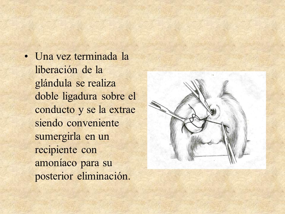 Una vez terminada la liberación de la glándula se realiza doble ligadura sobre el conducto y se la extrae siendo conveniente sumergirla en un recipiente con amoníaco para su posterior eliminación.