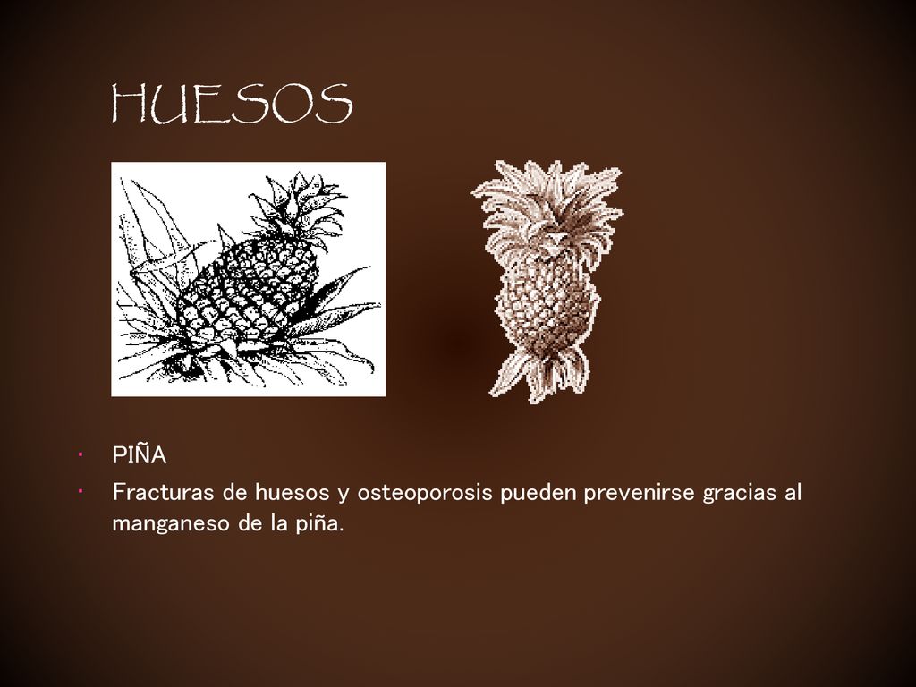 HUESOS PIÑA Fracturas de huesos y osteoporosis pueden prevenirse gracias al manganeso de la piña.