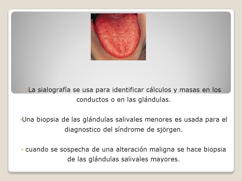 La sialografía se usa para identificar cálculos y masas en los conductos o en las glándulas.