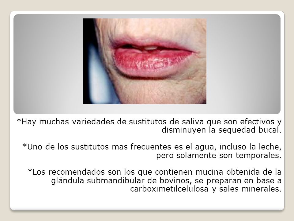 *Hay muchas variedades de sustitutos de saliva que son efectivos y disminuyen la sequedad bucal.