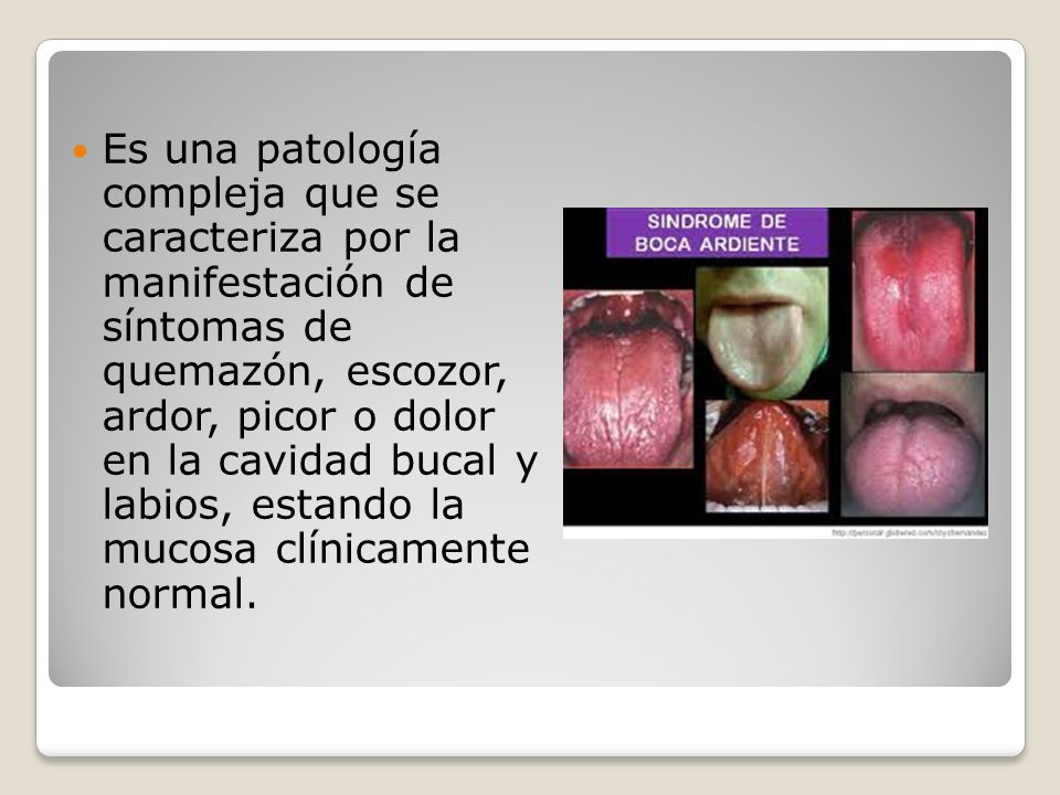 Es una patología compleja que se caracteriza por la manifestación de síntomas de quemazón, escozor, ardor, picor o dolor en la cavidad bucal y labios, estando la mucosa clínicamente normal.