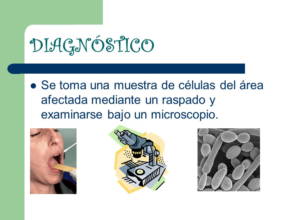 DIAGNÓSTICO Se toma una muestra de células del área afectada mediante un raspado y examinarse bajo un microscopio.
