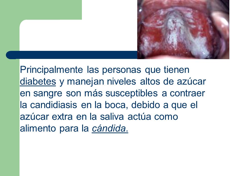 Principalmente las personas que tienen diabetes y manejan niveles altos de azúcar en sangre son más susceptibles a contraer la candidiasis en la boca, debido a que el azúcar extra en la saliva actúa como alimento para la cándida.