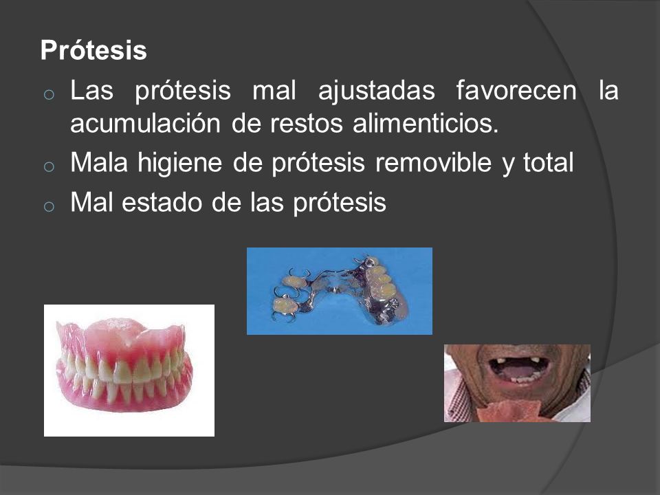 Prótesis Las prótesis mal ajustadas favorecen la acumulación de restos alimenticios. Mala higiene de prótesis removible y total.