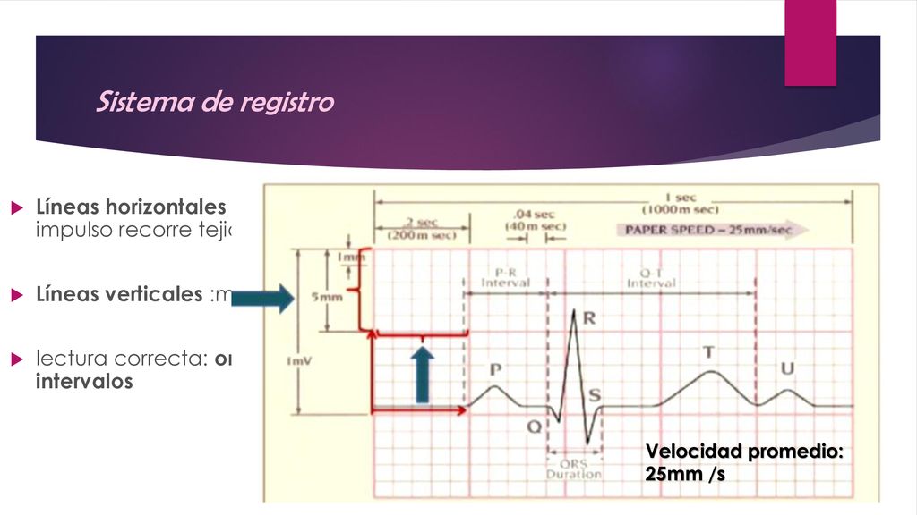 Sistema de registro Líneas horizontales :tiempo que el impulso recorre tejido cardiaco. Líneas verticales :magnitud impulso.