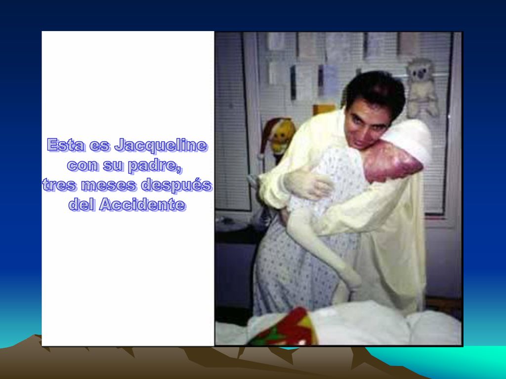 Esta es Jacqueline con su padre, tres meses después del Accidente
