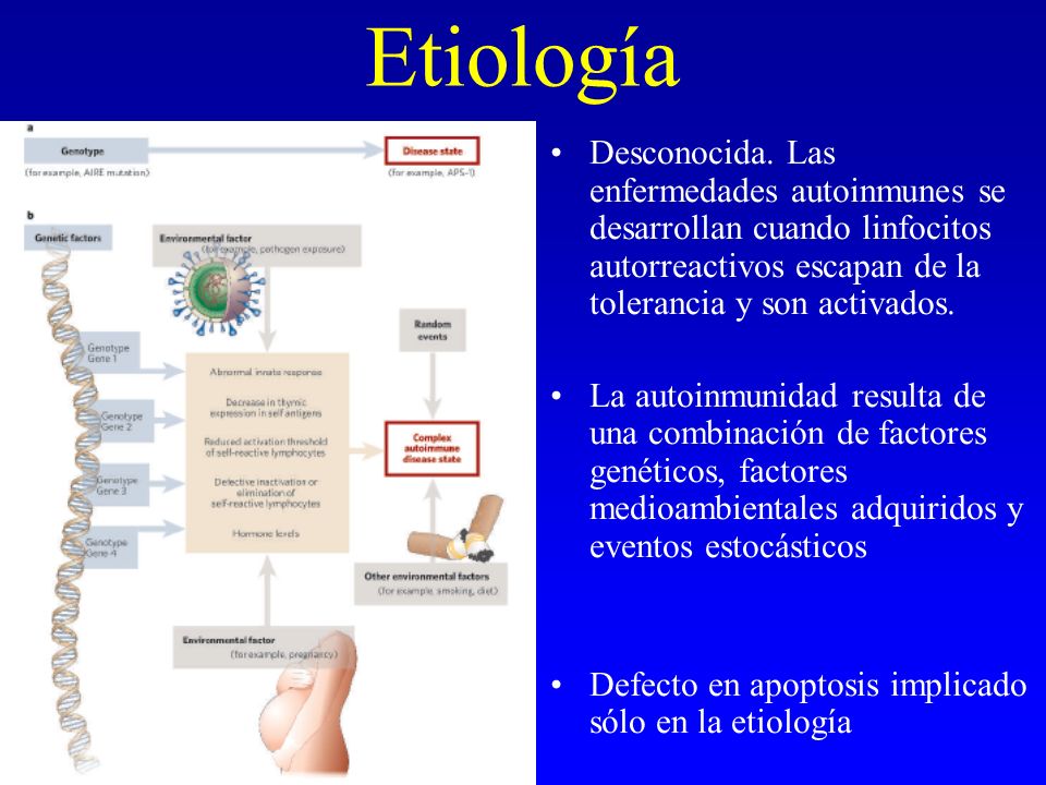 Etiología Desconocida. Las enfermedades autoinmunes se desarrollan cuando linfocitos autorreactivos escapan de la tolerancia y son activados.