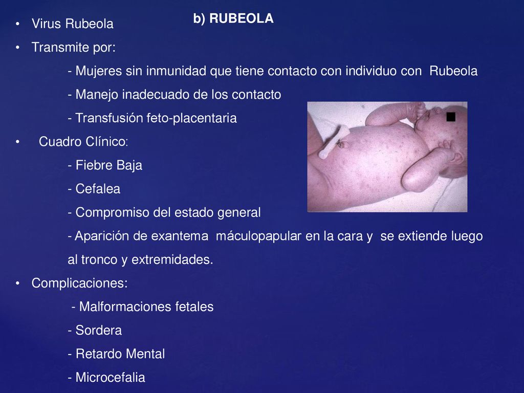 Virus Rubeola Transmite por: - Mujeres sin inmunidad que tiene contacto con individuo con Rubeola.