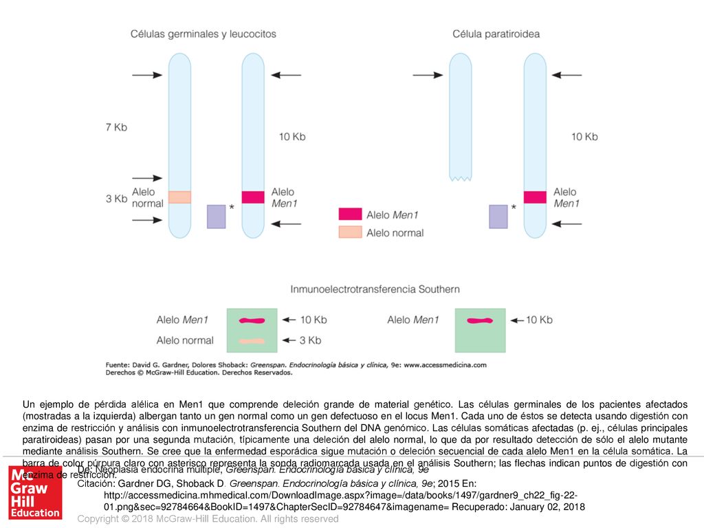 Un ejemplo de pérdida alélica en Men1 que comprende deleción grande de material genético. Las células germinales de los pacientes afectados (mostradas a la izquierda) albergan tanto un gen normal como un gen defectuoso en el locus Men1. Cada uno de éstos se detecta usando digestión con enzima de restricción y análisis con inmunoelectrotransferencia Southern del DNA genómico. Las células somáticas afectadas (p. ej., células principales paratiroideas) pasan por una segunda mutación, típicamente una deleción del alelo normal, lo que da por resultado detección de sólo el alelo mutante mediante análisis Southern. Se cree que la enfermedad esporádica sigue mutación o deleción secuencial de cada alelo Men1 en la célula somática. La barra de color púrpura claro con asterisco representa la sonda radiomarcada usada en el análisis Southern; las flechas indican puntos de digestión con enzima de restricción.