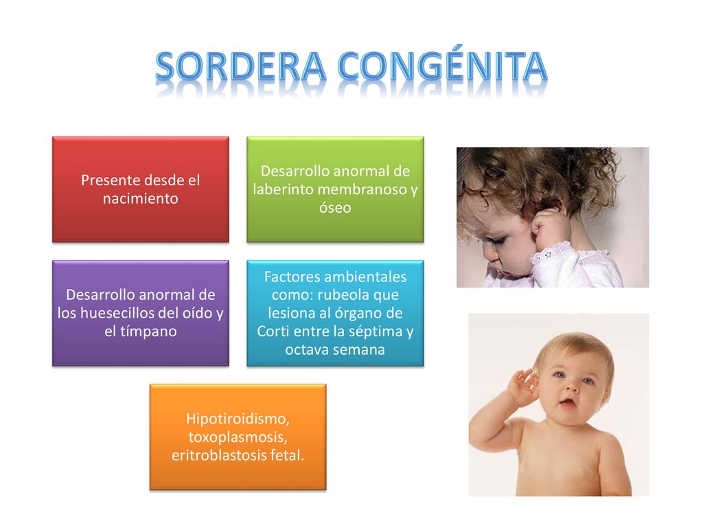 SORDERA CONGÉNITA Desarrollo anormal de laberinto membranoso y óseo