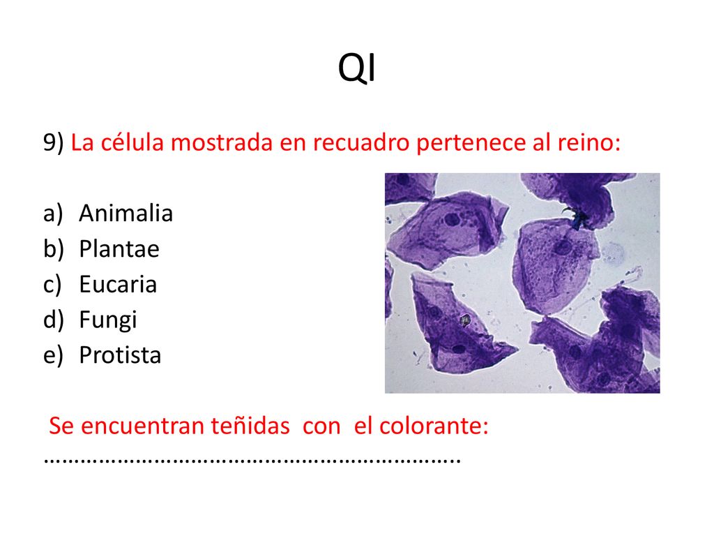 QI 9) La célula mostrada en recuadro pertenece al reino: Animalia