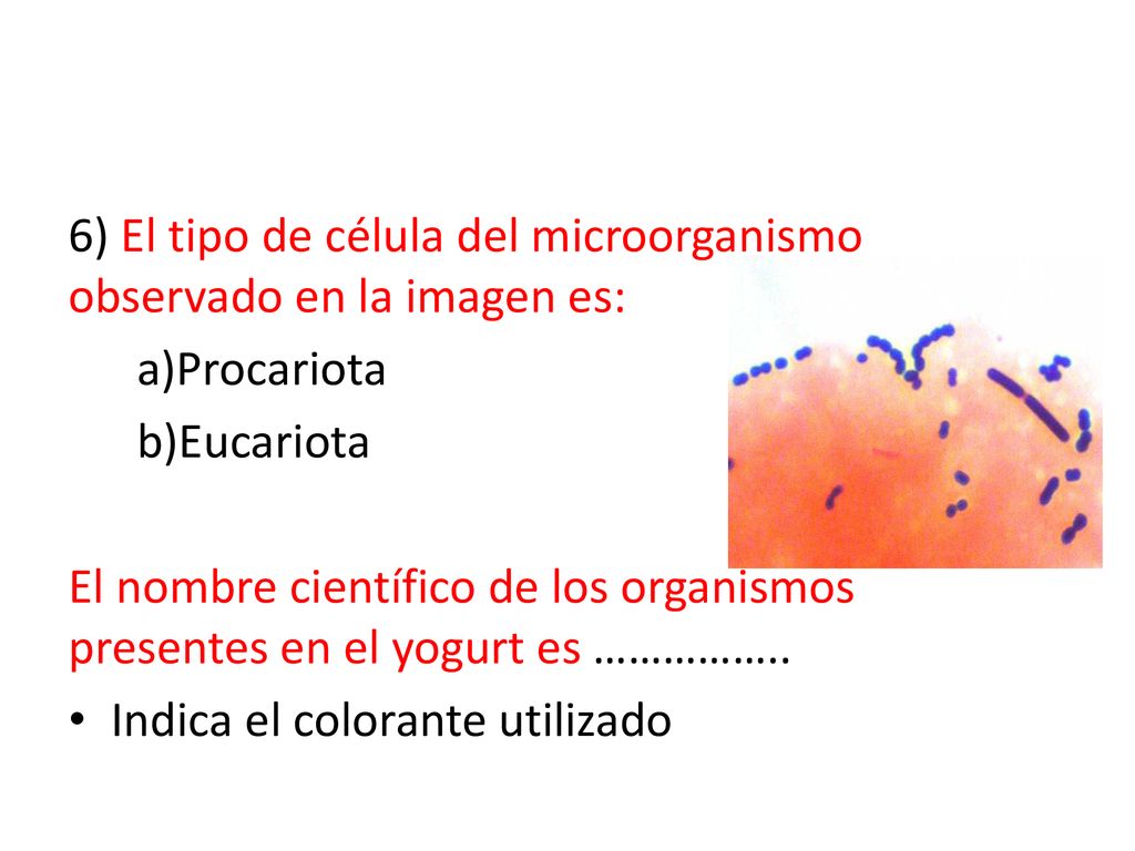 6) El tipo de célula del microorganismo observado en la imagen es: