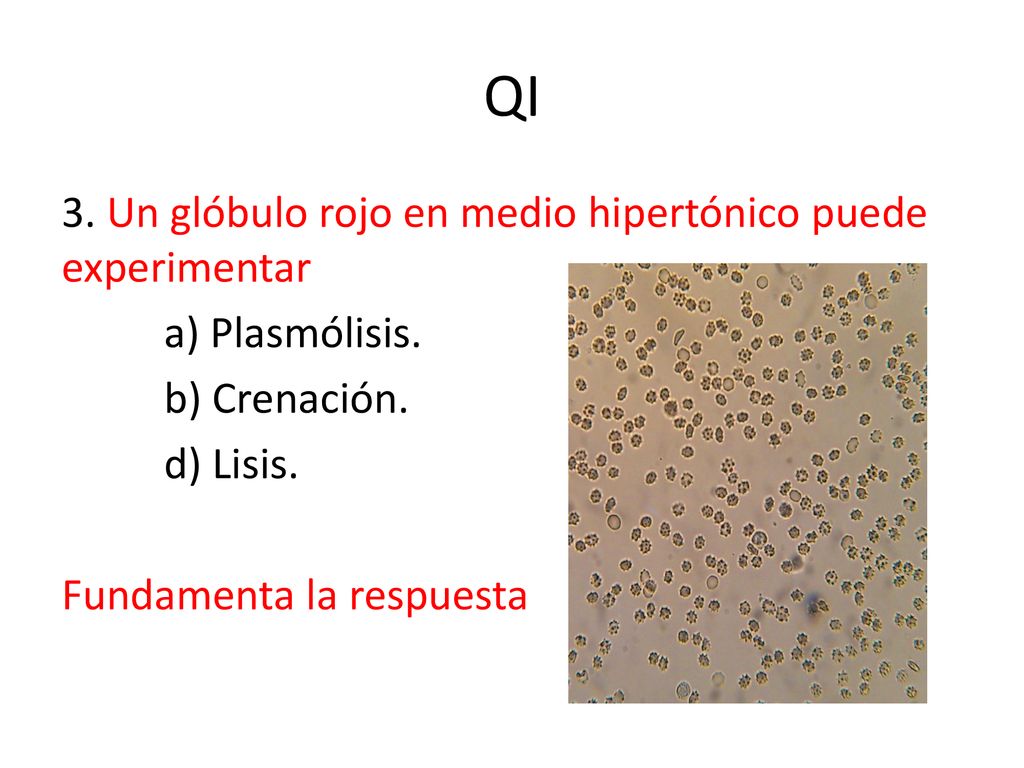 QI 3. Un glóbulo rojo en medio hipertónico puede experimentar