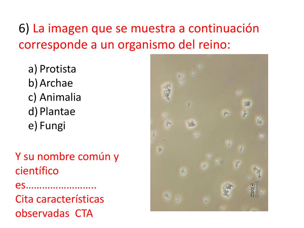 6) La imagen que se muestra a continuación corresponde a un organismo del reino: