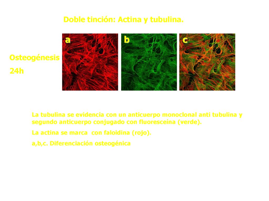 a b c Doble tinción: Actina y tubulina. Osteogénesis 24h