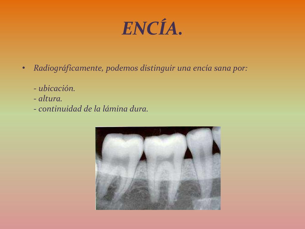 ENCÍA. Radiográficamente, podemos distinguir una encía sana por: - ubicación.