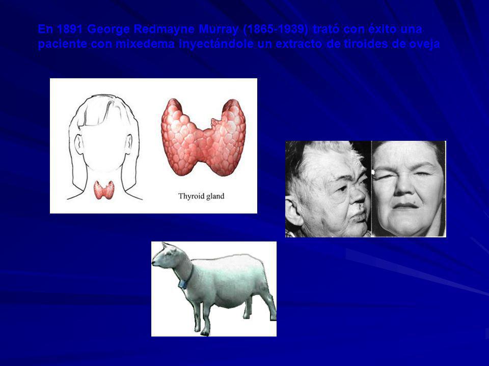 En 1891 George Redmayne Murray ( ) trató con éxito una paciente con mixedema inyectándole un extracto de tiroides de oveja
