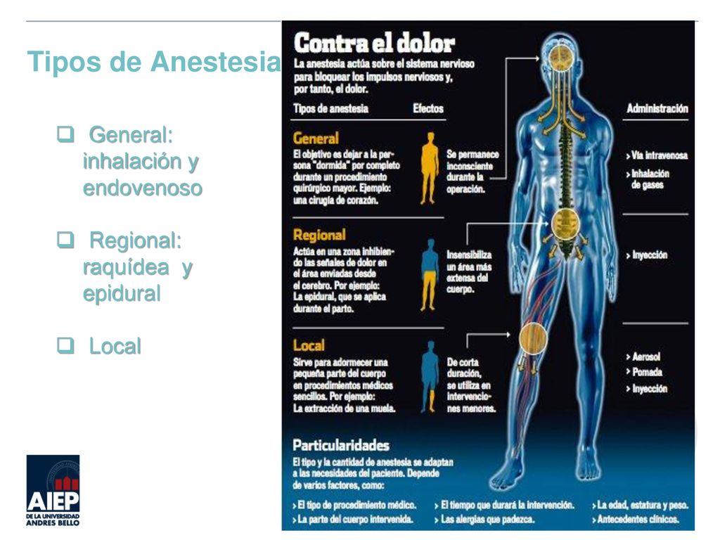 Tipos de Anestesia General: inhalación y endovenoso